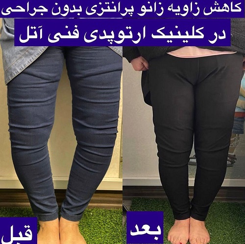 رضایت بیمار از درمان غیر جراحی اما نارضایتی ما